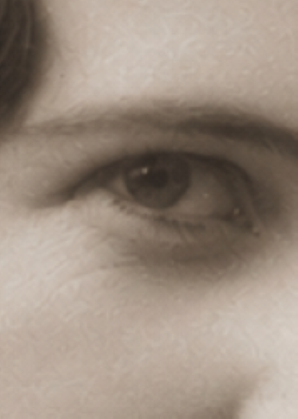 Facial detail after crease restoration