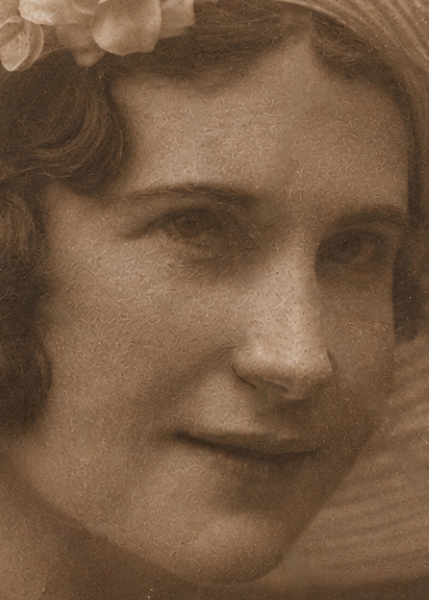 Creases across face after restoration