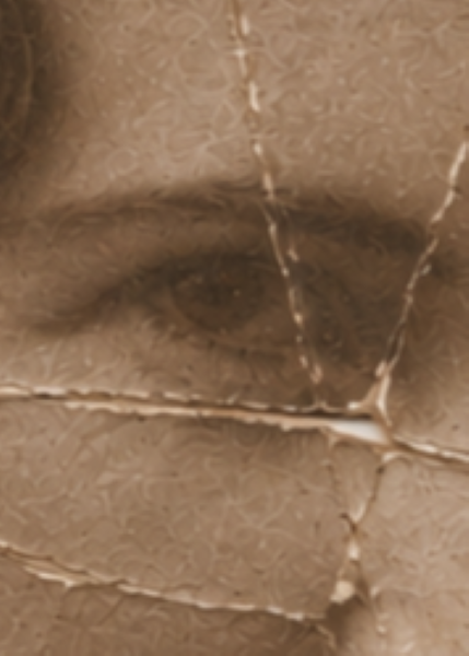 Facial detail before crease restoration